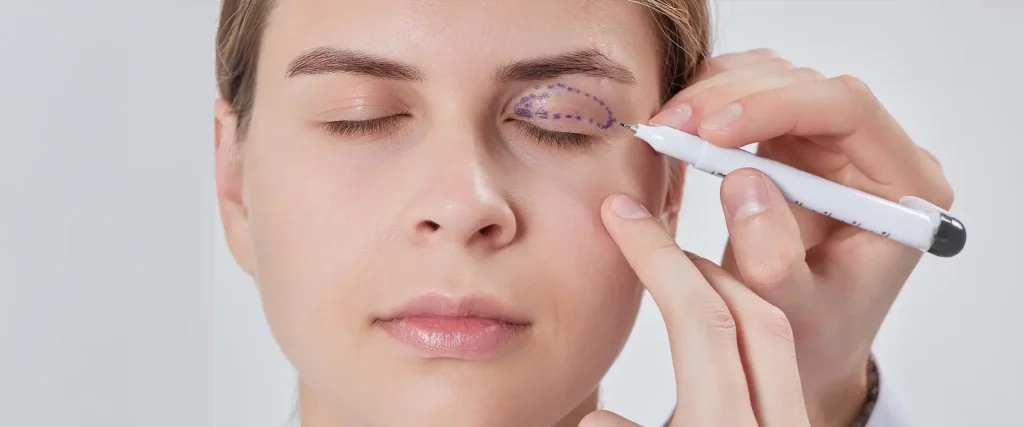 Eyelid Surgery Eyelid Surgery
